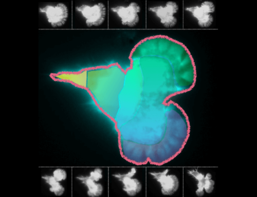 Hitze als Turbo-Antrieb für Immunzellen